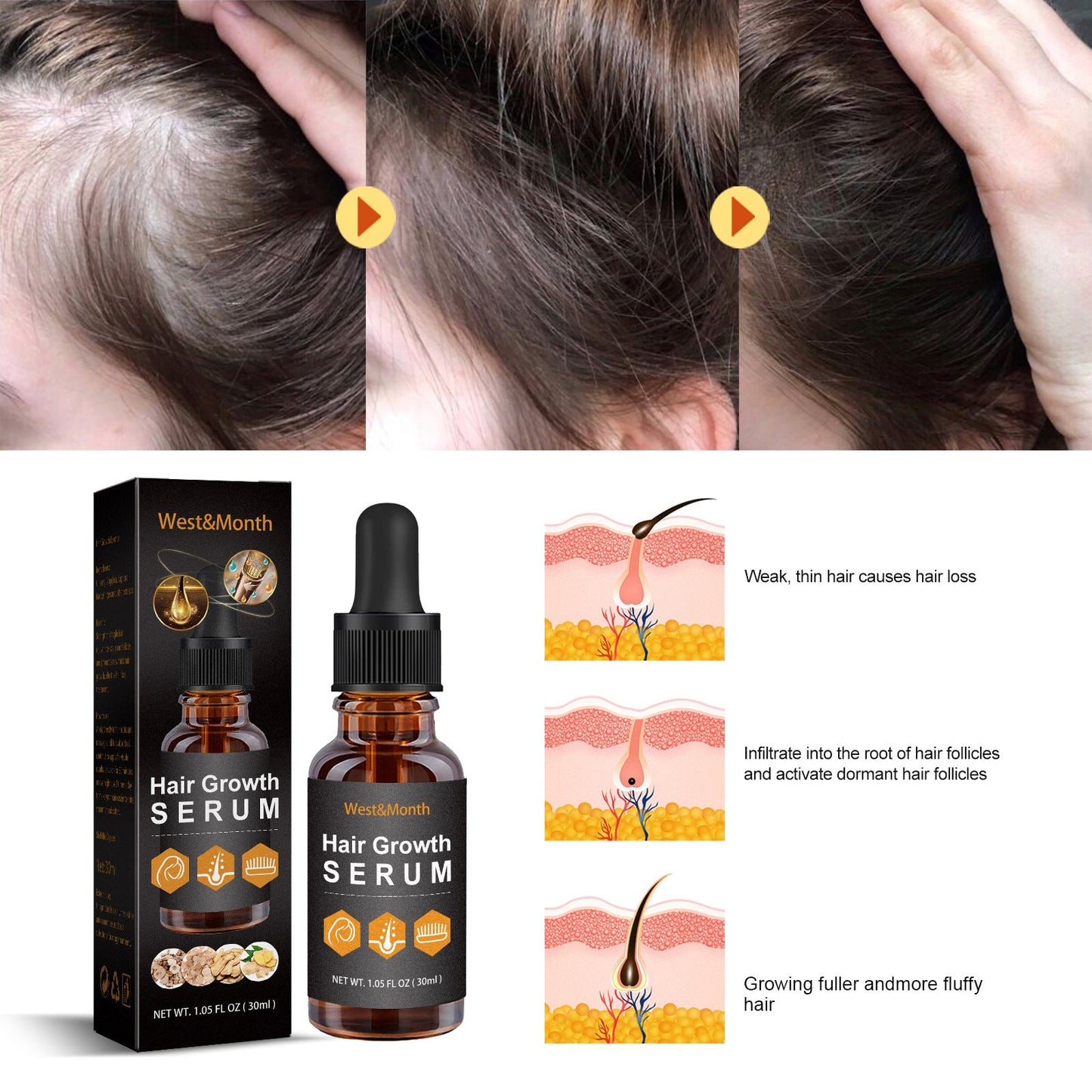 HairBoost Growth Essence